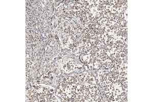 IHC analysis of SFXN5 using anti-SFXN5 antibody (ABIN7601388). (Sideroflexin 5 抗体  (AA 34-340))