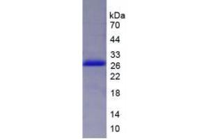 SDS-PAGE analysis of Human DVL2 Protein. (DVL2 蛋白)