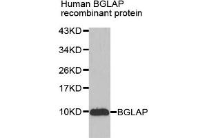 Western blot analysis of extracts of Human BGLAP recombinant protein, using BGLAP antibody. (Osteocalcin 抗体)