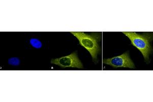 Immunocytochemistry/Immunofluorescence analysis using Rabbit Anti-Rab4 Polyclonal Antibody (ABIN361840 and ABIN361841). (Rab4 抗体  (C-Term))