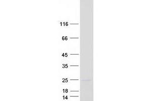 Western Blotting (WB) image for Coenzyme Q Biosynthesis Protein 7 (Coq7) protein (Myc-DYKDDDDK Tag) (ABIN2712501)
