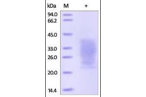 SDS-PAGE (SDS) image for Parathyroid Hormone 1 Receptor (PTH1R) (AA 27-188) protein (His tag) (ABIN2181675)