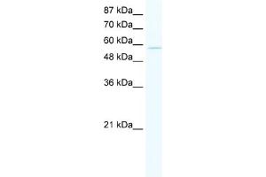 WB Suggested Anti-ZNF559 Antibody Titration:  5. (ZNF559 抗体  (N-Term))