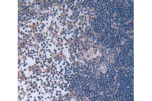 Used in DAB staining on fromalin fixed paraffin- embedded Kidney tissue (Leupaxin 抗体  (AA 1-208))