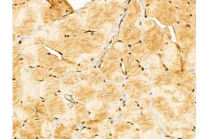 ABIN7094325 and ABIN7098372 at 1/100 staining Rat skin tissue by IHC-P.