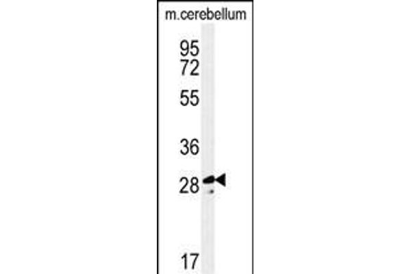 Tescalcin 抗体  (C-Term)