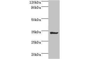 Western blot All lanes: Aminoacyl tRNA synthase complex-interacting multifunctional protein 1 antibody at 2 μg/mL + HepG2 whole cell lysate Secondary Goat polyclonal to rabbit IgG at 1/10000 dilution Predicted band size: 35, 38 kDa Observed band size: 35 kDa (AIMP1 抗体  (AA 25-180))