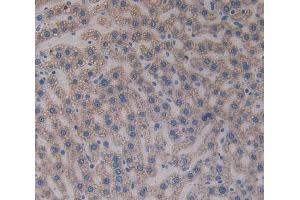 IHC-P analysis of liver tissue, with DAB staining. (Paxillin 抗体  (AA 327-568))