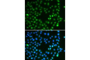 Immunofluorescence analysis of A549 cell using SALL4 antibody. (SALL4 抗体)