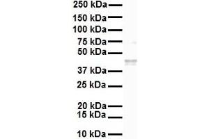 Western Blotting (WB) image for anti-Solute Carrier Family 27 (Fatty Acid Transporter), Member 2 (SLC27A2) (N-Term) antibody (ABIN2781594)