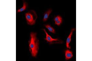 Immunofluorescent analysis of HER3 (pY1328) staining in MCF7 cells. (ERBB3 抗体  (C-Term, pTyr1328))