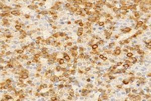 Immunohistochemistry analysis of paraffin-embedded rat pituitary gland using,GH1 (ABIN7074136) at dilution of 1: 2000 (Growth Hormone 1 抗体)