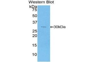 Western Blotting (WB) image for anti-Phosphoinositide-3-Kinase, Class 2, alpha Polypeptide (PIK3C2A) (AA 172-403) antibody (ABIN1860217) (PIK3C2A 抗体  (AA 172-403))