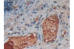 Immunohistochemistry (IHC) image for anti-Tumor Necrosis Factor (Ligand) Superfamily, Member 14 (TNFSF14) (AA 62-240) antibody (ABIN7436990)