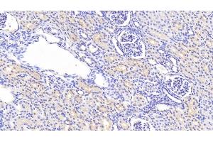 Detection of ACTN1 in Human Kidney Tissue using Polyclonal Antibody to Actinin Alpha 1 (ACTN1) (ACTN1 抗体  (AA 28-260))