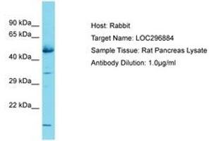 Image no. 1 for anti-Glucocorticoid Induced Transcript 1 (GLCCI1) (AA 255-304) antibody (ABIN6750335) (GLCCI1 抗体  (AA 255-304))