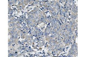 IHC analysis of FIS1 using anti-FIS1 antibody (ABIN7598965).