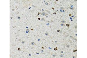 Immunohistochemistry of paraffin-embedded Rat brain using BHLHE40 Polyclonal Antibody at dilution of 1:100 (40x lens). (BHLHE40 抗体)