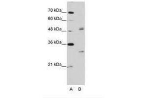 Image no. 2 for anti-Eukaryotic Translation Initiation Factor 4H (EIF4H) (AA 149-198) antibody (ABIN203036) (EIF4H 抗体  (AA 149-198))