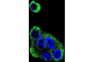 Immunofluorescence (IF) image for anti-Alcohol Dehydrogenase 1B (Class I), beta Polypeptide (ADH1B) antibody (ABIN3002782) (ADH1B 抗体)