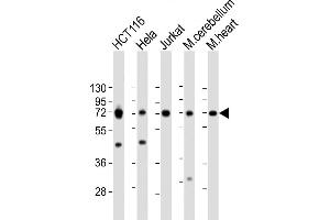 All lanes : Anti-TCF7L2 Antibody (N-term) at 1:2000 dilution Lane 1: HC whole cell lysate Lane 2: Hela whole cell lysate Lane 3: Jurkat whole cell lysate Lane 4: mouse cerebellum lysate Lane 5: mouse heart lysate Lysates/proteins at 20 μg per lane. (TCF7L2 抗体  (N-Term))