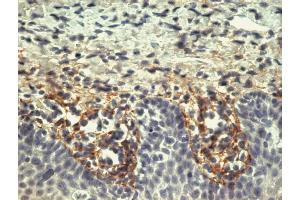 Immunohistochemistry staining of tonsil (paraffin-embedded sections) with anti-human tenascin C (T2H5). (TNC 抗体)
