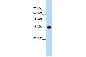 WB Suggested Anti-TNRC5 Antibody Titration:  0. (TNRC5 抗体  (C-Term))
