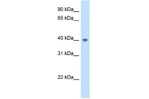 WB Suggested Anti-ABHD5 Antibody Titration:  5. (ABHD5 抗体  (N-Term))
