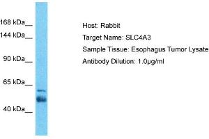 Host: Rabbit Target Name: SLC4A3 Sample Tissue: Human Esophagus Tumor Antibody Dilution: 1ug/ml (SLC4A3 抗体  (N-Term))