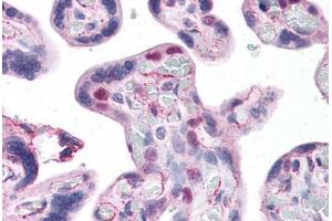 Human Placenta: Formalin-Fixed, Paraffin-Embedded (FFPE) (HMGB2 抗体  (AA 1-196))