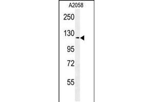 Western blot analysis in A2058 cell line lysates (35ug/lane). (NCKAP1 抗体  (AA 631-659))