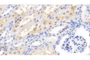 Immunohistochemistry (IHC) image for anti-Peroxiredoxin 6 (PRDX6) (AA 1-224) antibody (ABIN7443350)