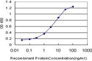 Detection limit for recombinant GST tagged RIPK2 is approximately 0. (RIPK2 抗体  (AA 431-540))