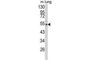 Western blot analysis of Fibulin-3 (arrow) in mouse lung tissue lysates (35ug/lane) using Fibulin-3  Antibody  (N-term). (FBLN3 抗体  (N-Term))