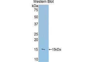 Western blot analysis of the recombinant protein. (RALBP1 抗体  (AA 403-499))