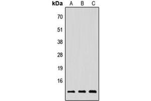 Western blot analysis of NRG4 expression in HEK293T (A), Raw264. (Neuregulin 4 抗体  (Center))