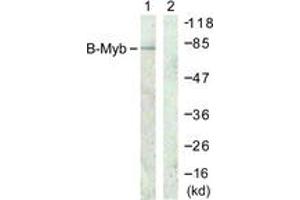 Western blot analysis of extracts from A549 cells, using B-Myb (Ab-577/581) Antibody. (MYBL2 抗体  (AA 551-600))