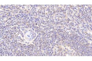 Detection of PARK7 in Human Spleen Tissue using Polyclonal Antibody to Parkinson Disease Protein 7 (PARK7)
