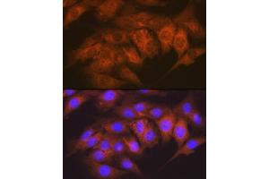 Immunofluorescence analysis of C6 cells using CaMKII delta Rabbit mAb (ABIN7266019) at dilution of 1:100 (40x lens). (CAMK2D 抗体)