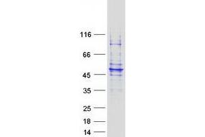 Western Blotting (WB) image for Glutaryl-CoA Dehydrogenase (GCDH) (Transcript Variant 1) protein (Myc-DYKDDDDK Tag) (ABIN2721759)