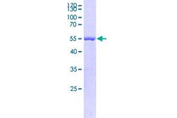 CHAC1 Protein (AA 1-222) (GST tag)