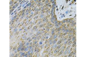 Immunohistochemistry of paraffin-embedded Human esophagus using AK1 Polyclonal Antibody at dilution of 1:100 (40x lens). (Adenylate Kinase 1 抗体)
