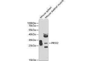 Western blot analysis of extracts of various cell lines, using PRSS2 antibody (ABIN6131363, ABIN6146279, ABIN6146280 and ABIN6223919) at 1:1000 dilution. (PRSS2 抗体  (AA 24-247))