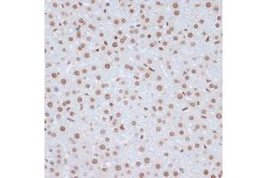 Immunohistochemistry of paraffin-embedded rat liver using Phospho-ERK1-Y204 antibody (ABIN3019889, ABIN3019890, ABIN3019891 and ABIN1681795) at dilution of 1:100 (40x lens).