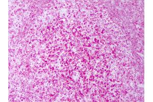 Anti-CD74 antibody IHC of human tonsil, lymphocytes. (CD74 抗体)