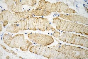 Immunohistochemistry was performed on paraffin-embedded mouse skeletal muscle using desmin antibody (ABIN7798314), 1:200). (Recombinant Desmin 抗体)