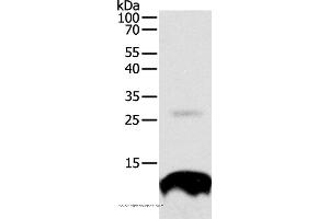 Western blot analysis of 293T cell, using TNFRSF12A Polyclonal Antibody at dilution of 1:300 (TNFRSF12A 抗体)