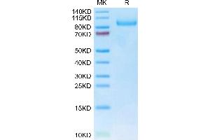 Human Neuropilin-1 on Tris-Bis PAGE under reduced condition. (Neuropilin 1 Protein (NRP1) (AA 22-644) (His tag))