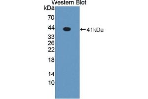 Detection of recombinant LXRa using Polyclonal Antibody to Liver X Receptor Alpha (LXRa) (NR1H3 抗体  (AA 95-434))