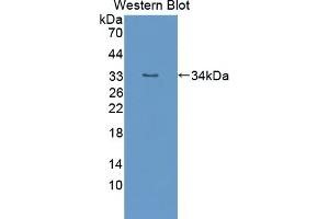 Detection of Recombinant TTK, Mouse using Polyclonal Antibody to TTK Protein Kinase (TTK) (Mps1 抗体  (AA 527-786))